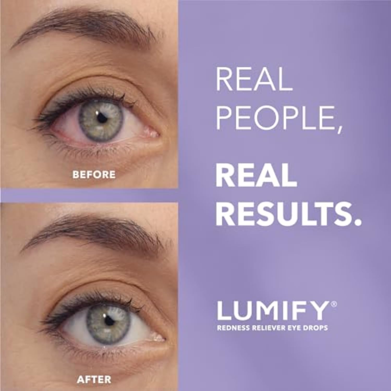 LUMIFY Redness Reliever Eye Drops - Image 4